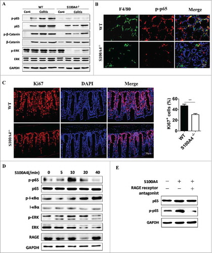 Figure 6. NF-κB signaling in Macrophages is critical for the protection against colon tumorigenesis. Groups of S100A4−/− and WT mice (n = 5 per group) were treated as Fig 5 (A). (A) The protein levels of p-p65, p-β-catenin and p-ERk in colon tissues on day 10 after DSS were analyzed by Western blotting. (B) Sections from DSS-treated colon tissues of S100A4−/− and WT mice were double stained with F4/80 (green) and p-p65 (red). Scale bar, 50 μm. (C) Sections from DSS-treated colon tissues of S100A4−/− and WT mice were stained with Ki67, and the percentages of Ki67 in colons are shown. Scale bar, 50 μm. (D-E) RAW cells were cultured without or with S100A4 (200 ng/ml) or RAGE inhibitor for 2 h as indicated. The levels of p65, p-p65, IKBα, p-IKBα, ERK, p-ERK and RAGE were determined by Western blotting.