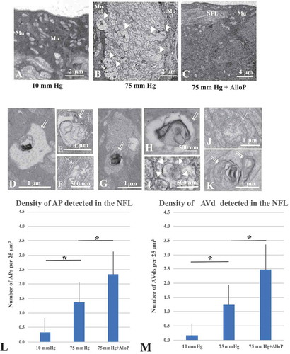 Figure 4. Electron micrographic analyses of ex vivo retinas. (A) 10 mm Hg. Mu, Müller cell. (B) 75 mm Hg. Arrowheads; swollen axons. Mu, Müller glia. (C) AlloP at 75 mm Hg. Mu, Müller glia. NFL; Nerve fiber layer. (D-F) AVds (double arrows in D, E) and AP (single arrow, F) in the NFL at 10 mm Hg. (G-I) AVds (double arrows in G, H) and phagophore (arrowheads in I) in the NFL at 75 mm Hg. (J and K) AP (single arrow) and AVds (double arrows) in the retina incubated with 1 μM AlloP. (L) The number of AP per 25 μm2 of retina (n = 30 per experiment, Tukey *p < 0.05). (M) The number of AVd per 25 μm2 of retina (n = 30 per experiment, Tukey *p < 0.05)