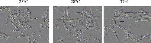 Figure 6. The cell morphology of T. cutaneum B3 cultivated on YEPD medium at different temperature. The cells were photographed at 1000× magnifications after 72 h growth on the medium and the inoculum was 100% yeast-like cells.