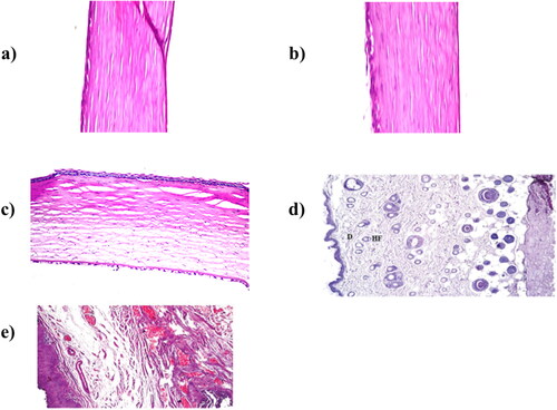 Figure 5. Histopathological photomicrographs after instillation of a) O-NV (rabbit cornea), b) O-OLN (rabbit cornea), c) O-TP (rabbit cornea), d) T-CE (rat skin) and e) V-TP (vaginal tissue) (Albash et al., Citation2020; Citation2021a,b; Ahmed et al., Citation2022a,b).
