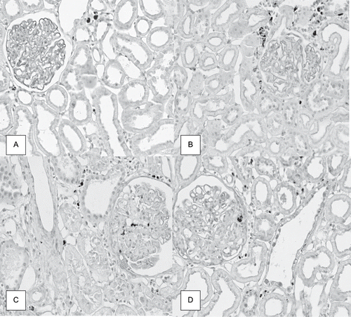 Figure 2. Immunolocalization of ED1 (macrophages/monocytes) in renal cortex of rats from dams submitted to high-sodium intake (B and D) and of the same age control rats (A and C) at 120 days after nephrectomy (C and D) or a sham operation (A and B), × 280.