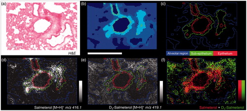 Figure 4. (a) H&E from dual dosed lung section focus on analyzed region. (b) Spatial clustering of high spatial resolution (10 µm) MSI of corresponding region showing similarities between tissue compartment molecular composition. (c) Region of Interest (ROI) generation from segmentation results corresponding to three tissue sub-structures (triplicate biological replicates). MS Images of inhaled (d), IV administered salmeterol (e), and overlay of both distributions (f). Data shows discrete localization of inhaled salmeterol to epithelium and sub-epithelium compared to IV dosed salmeterol within alveolar regions at 30 min after delivery. Intensity scale 0–100% for both salmeterol versions. Scale bar = 600 µm.