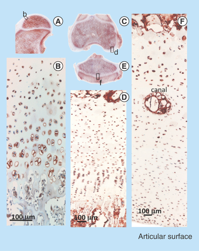 Figure 10.  Immunolocalization of FGF-2 expressed by articular and growth plate chondrocytes in a newborn ovine hip (A) and femoral condyle (C) and tibial plateau (E) of the knee. FGF-2 is a pericellular component of articular chondrocytes (B, D) and epiphyseal growth plate chondrocytes (F). FGF-2 is also strongly expressed in bone marrow (A, C & E).