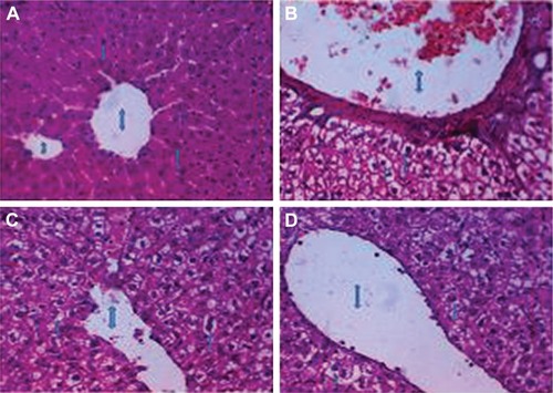 Figure 7 Histology of liver. (A) Untreated healthy liver (negative control, Group I), (B) liver from diabetic rat (positive control, Group II), (C) liver from diabetic rat (positive control, Group II), (D) liver from diabetic rat treated with [(FA2−)(VO2+)]⋅3H2O complex (Group IV). H&E stain 400×.