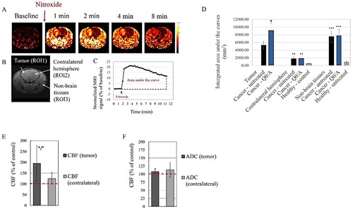 Figure 2. Effects of coenzyme Q0/ascorbate (Q0/A) on tissue redox status, cerebral perfusion assessed by cerebral blood flow (CBF), and cell density assessed by apparent diffusion coefficient (ADC) in glioblastoma-bearing mice: (A) Representative nitroxide-enhanced magnetic resonance images of glioblastoma-bearing brain, obtained at different time intervals after intravenous injection of nitroxide probe (mito-TEMPO) – a marker of tissue redox activity. Color images represent the calculated extracted MRI signal obtained after injection of the nitroxide probe and normalized to the baseline (native) signal obtained before injection. (B) Definition of regions-of-interest (ROIs): ROI1 – tumor area; ROI2 – contralateral hemisphere; ROI3 – non-brain issues (black and white image). (C) Representative calculated kinetic curve of nitroxide-enhanced MRI signal in a glioblastoma-grafted mice, obtained within 12 min after i.v. injection of mito-TEMPO. The areas under the curves were integrated and the averaged data are presented in (D). (D) Integrated areas under the kinetic curves obtained by different experimental groups. *p < 0.05 versus tumor (ROI1); ##p < 0.01, ###p < 0.001 versus healthy untreated mice. Data means ± SD from 3 mice in each group with three measurements (slices) per mouse. (E, F) Effects of Q0/A on brain perfusion analyzed by CBF (E) and cell density analyzed by ADC (F) using brain MRI of glioblastoma-bearing mice within two weeks after intracranial injection of the drug. *p < 0.05 versus Control (untreated) group; #p < 0.05 tumor versus contralateral hemisphere. Data are means ± SD from 3 mice in each group.
