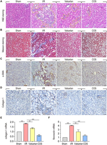 Figure 5. COS administration attenuates renal interstitial fibrosis at 2 months after renal I/R injury. (A) Renal morphology was examined with H&E staining. Areas bordered by yellow dotted line shows the pathological changes in kidney. Scale bar represents 50 μm. (B) Renal interstitial fibrosis was detected using Masson trichome staining. Arrows show extracellular matrix deposition around renal tubules. Scale bar represents 50 μm. (C) Immunohistochemical staining of α-SMA. Scale bar represents 50 μm. (D) IHC analysis of Collagen I in kidney tissues. Scale bar represents 50 μm. (E-F) mRNA expression of Collagen I and Fibronectin relative to GAPDH (mean ± SEM, *p < 0.05, n = 8).