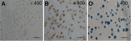 Figure 2 Morphology of dendritic cells labeled with 25 μg/mL superparamagnetic iron oxide particles after 12 hours incubation (Prussian blue staining, ×400). (A) unlabeled dendritic cells, (B) dendritic cells labeled with superparamagnetic iron oxide, and (C) labeled dendritic cells with Prussian blue staining.Note: Scale: 50 μm.