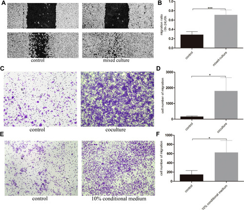 Figure 3 Normal basal epithelial cells could stimulate the migration of RM-1 directly or indirectly. (A) Effect of basal epithelial cells on cells wound healing of RM-1 was determined after being mixed-cultured (1:1) for 0 h and 24 h. (B) Quantification of migrated width of wound healing assay. (C) Effect of basal epithelial cells on migration of RM-1 was determined after being co-cultured for 20 h. (D) Quantification of migrated cells in (C). (E) Effect of 10% conditional medium of basal epithelial cells on migration of RM-1 was estimated after being cultured for 20 h. (F) Quantification of migrated cells in (E). Values are represented by mean±SD from at least three independent experiments. “*” represents “p<0.05”, “***” represents “p<0.001” vs control group.