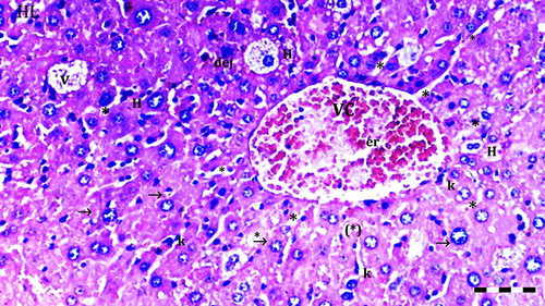 Figure 4 Representative light microscopy of hepatic tissue from DIR-FC60 group. Scale bar 50 µm, H&Ex100.