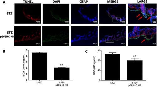 Figure 8. The in vivo p66SHC knockdown ameliorates oxidative damage in EGCs under hyperglycemic stress. Mice were intestinal-intramuscular injected with AAV-9-p66SHC shRNA for 7 days and then injected with STZ for 5 days. A: Cell apoptosis of EGCs in the duodenum of DM mice was analyzed using immunofluorescence analysis (TUNEL: red fluorescence, GFAP: green fluorescence, DAPI: blue fluorescence). B&C: The samples of duodenum tissues were collected from CT and DM mice. MDA level of tissues was assessed using TBA assay and SOD activity of tissues was assessed using NBT assay. ** p < 0.01 vs. DM. CT: control; STZ: DM (6 weeks post STZ-injection).