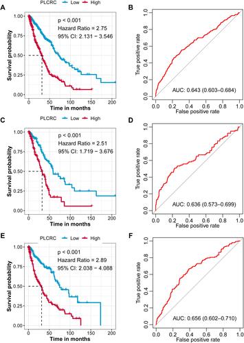 Figure 2 Prognostic value of PLCRC in entire, LUAD and LUSC cohorts. (A) Kaplan-Meier (K-M) plot shows the different OS dichotomized by PLCRC in entire cohort; (B) The receiver operating characteristic (ROC) curve shows the prognostic value of PLCRC in entire cohort; (C), K-M plot shows the different OS dichotomized by PLCRC in LUAD cohort; (D) ROC curve shows the prognostic value of PLCRC in LUAD cohort; (E) K-M plot shows the different OS dichotomized by PLCRC in LUSC cohort; (F) ROC curve shows the prognostic value of PLCRC in LUSC cohort.