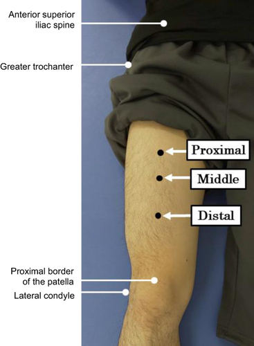 Figure 1 The proximal, middle, and distal locations of US scanning.