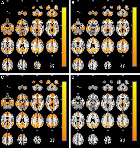 Figure 1 The cross-sectional MRI images of brain activation regions (yellow areas) related to DMN (the left posterior cingulate cortex as the seed) among four groups.