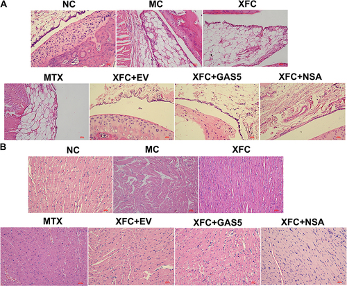 Figure 2 Effects of XFC on the histopathology of synovium and myocardium in AA rats (HE, ×200).