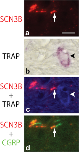 Figure 8. Microphotographs of sodium voltage-gated channel beta subunit 3 (SCN3B) (a, c, d), and tartrate-resistant acid phosphatase (TRAP) (b, c), and calcitonin gene-related peptide (CGRP) (d) in the compression area of the PDL after 5 days of tooth movement. All panels are in the same field of view. Arrows in a-d show nerve varicosities containing SCN3B and CGRP. The varicosities are near a TRAP-positive multinuclear cell (arrowheads in b and c). Scale bar = 10 μm (a). All panels are at the same magnification.