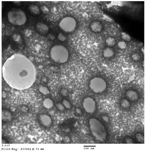 Figure 4. TEM image of optimized RLX-PL-MEL. RLX: raloxifene; PL: phospholipid; MEL: melittin.