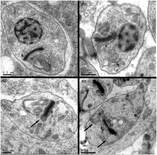 Figure 8. Transmission electron microscopy of mammalian cells infected by T. cruzi and treated with HAD1 compound. Untreated controls showing normal general amastigote structure and regular kinetoplasts (k) from cardiomyocyte (A) and macrophage (B) infected cultures. Forty-eight hours treatment of HAD1 at IC50 concentration (30 µM) induced swelling of kinetoplasts (black arrows) both in cardiomyocyte (B) and in macrophage (D)-infected cultures.