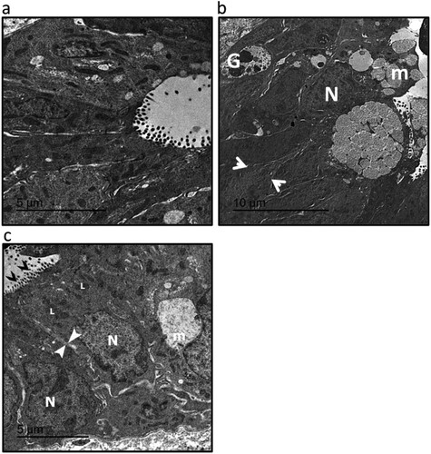 Figure 3. Electromicrographs (transmission electron microscopy) of colon samples from the control group (a), ulcerative colitis (UC, b) and UC treated with 15 mg/kg sulforaphane (c). Images represented Goblet cell nucleus (G), mucus granules (m), typical microvilli (black arrows heads), enterocytes nucleus in a basal position (N), lysosomes (L) and intercellular space (between white arrow heads). Scale bar is 5 µm. The micro-images represented the results of examining three rats in each group with examination of 10 fields in each rat.