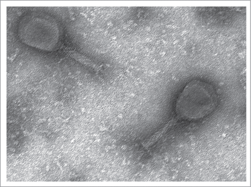 Figure 3. Electron micrograph of the coliphage EcD7 (magnification × 80,000).