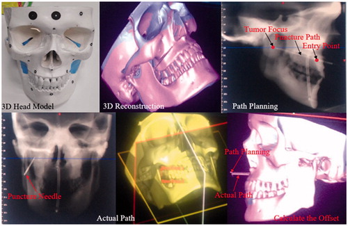 Figure 8. Simulated model of cranial and maxillofacial surgery.