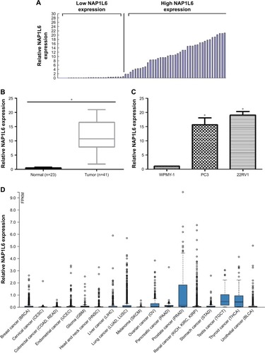 Figure 1 Relative NAP1L6 expression in PCa and its clinical significance. (A) According to the cut-off value of the relative NAP1L6 expression, relative low-NAP1L6 and high-NAP1L6 patients were 27 and 48, respectively. (B) Relative expression of NAP1L6 in PCa tissues. (C) Relative expression of NAP1L6 in PCa cell lines PC3 and 22RV1 compared with WPMY-1. (D) NAP1L6 was upregulated in PCa according to the TCGA data. Data represent the mean ± SD from three independent experiments. *P<0.05.