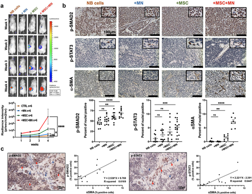 Figure 6. TAM and CAF activate a TGF-β1-IL-6 signaling pathway in NB tumors.