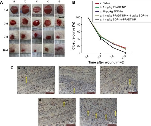 Figure 10 SDF-1α-PPADT nanoparticles that promoted wound vascularization and wound healing.Notes: (A) 6-week-old BALB/c mice with full-thickness skin defects were injected intravenously with (a) saline, (b) blank nanoparticles, (c) blank nanoparticles + SDF-1α, (d) SDF1α, (e) SDF-1α-PPADT nanoparticles. The mice that received SDF-1α-PPADT nanoparticles displayed the most accelerated wound healing. Wounds were fully closed on day 10, and the wounds on mice in the other four groups were still not completely closed. (B) The closure curve showed higher wound closure rate in mice injected with SDF1α-PPADT nanoparticles (P<0.05). (C) Immunohistochemistry assays showed that the wounds on mice injected intravenously with SDF1α-PPADT nanoparticles (e) contained more CD31-positive blood vessels than those on mice injected intravenously with (a) saline, (b) blank nanoparticles, (c) blank nanoparticles + SDF-1α, (d) SDF-1α, indicating they were more vascularized. The yellow arrows point to blood vessels. Vascular endothelial cells can be labeled by the CD31 antibody, and turn red.Abbreviations: SDF-1α-PPADT, SDF-1α-loaded PPADT; d, day; PPADT, poly-(1,4-phenyleneacetone dimethylene thioketal); SDF-1α, stromal cell-derived factor-1α; NP, nanoparticle.
