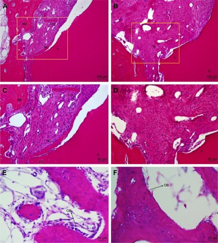 Figure 7 Histologic photomicrographs of the mesiodistal section of defects in experimental (A, C, E) and control (B, D, F) sites in beagle dogs.Notes: (A) In the experimental site, residual biomaterials were not observed, and there were no signs of inflammatory cell infiltration. New cementum and connective tissue were observed at the notch area. (C) Higher magnification of the framed area in (A). Newly formed cementum (NC) was observed on the denuded root surface, and free cementoid-like tissue (Cm) was found inside the connective tissue. The coronal end of the old cementum (OC) is shown. (B) Fibrous tissue (fb) occupying the notch area in the control group. Mild root resorption was observed at the coronal portion of the notch. (D) Higher magnification of the framed area in (B). (E) Osteoblasts (OB) in the experimental site showed various shapes from cuboidal to tall columnar with basally located nuclei and had high osteogenic activity. (F) In the control site, the OB were flat with nonprominent nuclei.Abbreviations: NB, new bone; D, dentin; n, notch; c, connective tissue.