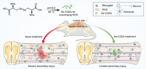 Figure 1 Schematic illustration of the Se-CQDs preparation for the treatment of TSCI. Water-soluble Se-CQDs were prepared by hydrothermal treatment of L-selenocystine. After intraspinal injection, the Se-CQDs efficiently scavenged ROS, consequently reducing inﬂammation, preventing neuronal apoptosis and demyelination, thereby improving the recovery of locomotor function of rats with TSCI.