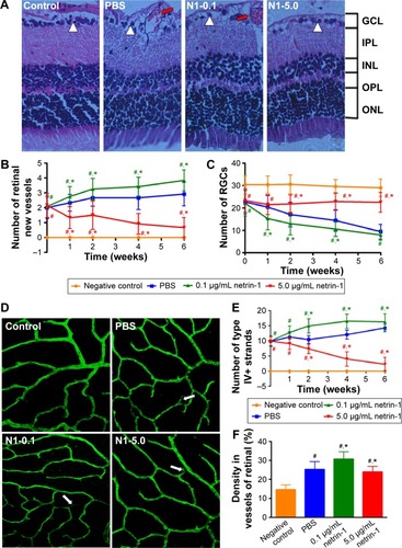 Figure 7 Retinal structure and vascular changes in the innermost vascular plexus in the four groups.