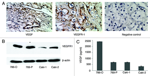 Figure 1. VEGF and VEGFR-1 are expressed in human CRCC tumors and cell lines. (A) Immnohistochemical staining of VEGF and VEGFR-1 in human CRCC tumor sections (brown staining). (B) Protein gel blot analysis of VEGFR-1 expression in CRCC cell lines. Protein gel blot of β-actin is included as a loading control. (C) VEGF ELISA analysis of VEGF levels in CRCC cells.