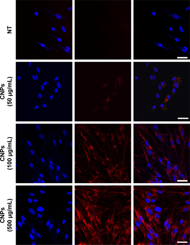 Figure S3 Dose-dependent (0, 50, 100, and 500 µg/mL) cellular uptake of CNPs in IPF fibroblasts in the absence of collagen matrix at 30 h post-incubation (NT; non-treated cells). Scale bars = 25 µm.Abbreviations: CNPs, glycol chitosan nanoparticles; IPF, idiopathic pulmonary fibrosis.