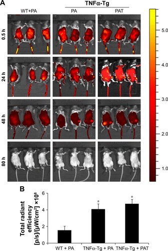 Figure 3 PA and PAT target the inflammatory joints of TNFα-Tg mice. (A) Bioluminescent images of PA-ICG-treated WT mice, and PA-ICG- or PAT-ICG-treated TNFα-Tg mice were taken intermittently at 0.5, 1, 4, 24, 48 and 80 h after injection. (B) Fluorescence intensity of the knee joint at 24 h post-administration. The values are the mean ± SD of 6 legs from 3 mice. *P<0.05, compared with the WT + PA group.Abbreviations: WT, wild type; PA, poly-γ-glutamic acid-grafted di-tert-butyl L-aspartate hydrochloride; TNFα-Tg, tumor necrosis factor α transgenic; PAT, TP-loaded poly-γ-glutamic acid-grafted di-tert-butyl L-aspartate hydrochloride; ICG, indocyanine green.