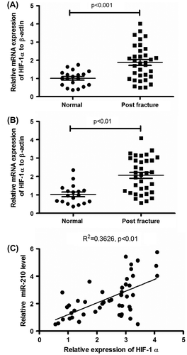 Fig. 1. microRNA-210 is upregulated in bone tissues post-fracture and is positively correlated with HIF-1α levels.Notes: (A) Relative microRNA-210 expression, examined by RT-qPCR, in normal bone tissues (n = 18) or bone tissues post-fracture (n = 34). (B) Relative HIF-1α mRNA level in bone tissues post-fracture (by RT-qPCR). (C) Correlation between the relative microRNA-210 expressions with the HIF-1α mRNA expression. And statistical significance was considered with a p value <0.05 or less.