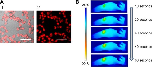 Figure 6 Photothermal imaging and therapy of UCNPs-PANPs.Notes: (A) Cancer cells were first incubated with UCNPs-PANPs samples (100 µg mL−1) for 4 hours and irradiated by 808 nm laser (0.5 W cm−2) for 15 minutes. Cells were then stained with PI for 10 minutes (2). The overlay of fluorescence image and bright-field image (1). (B) Photothermal images of nude mouse injected with UCNPs-PANPs (50 µL, 1 mg mL−1) exposed to the 808 nm laser at the power densities of 0.5 W cm−2 recorded within 60 seconds. Tumor growth rates (C) and survival curves (D) of experiment group (UCNPs-PANPs + laser), materials group (UCNPs-PANPs), laser group (laser), and blank group (blank).Abbreviations: PI, propidium iodide; UCNPs, upconversion nanoparticles; UCNPs-PANPs, polyaniline-coated UCNPs.