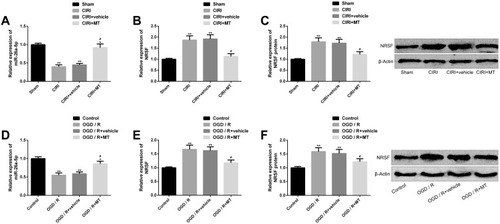 Figure 4 Effect of MT on miR-26a-5p and NRSF in CIRI in vitro and in vivo models. (A) miR-26a-5p is significantly downregulated in CIRI in vivo model, while MT can restore miR-26a-5p expression. (B–C) The expression of NRSF and protein level in CIRI in vivo model are significantly upregulated, while MT can silence NRSF and its protein map. (D) miR-26a-5p is significantly downregulated in the OGD/R in vitro model, and MT can upregulate the miR-26a-5p expression. (E–F) In vitro model of OGD/R, NRSF expression and protein level are significantly upregulated, MT can silence NRSF and its protein map.