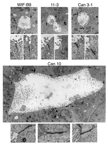 Figure 2. Transmission electron microscopy pictures of bile canaliculi and tight junctions of cell lines expressing typical hepatocyte polarity. For each cell line, a representative bile canaliculus (upper part) and two or three examples of tight junctions (lower part) are presented. The images of bile canaliculi are shown at the same magnification, with sealing tight junctions indicated by arrows. The images of tight junctions are presented at a 3-fold higher magnification than canaliculi. Note the high number of cells and junctions implicated in the formation of the canaliculus of Can 10. Bars, 500 nm.