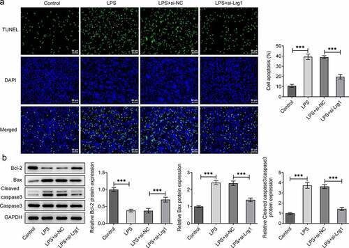 Figure 3. Silencing of Lrg1 ameliorates the apoptosis of LPS-induced mouse hippocampal neuronal cells. (a) TUNEL assay was to detect cell apoptosis. (Magnification, x200). (b) Western blot was to analyze the protein levels of apoptosis-related factors. ***P<0.001.