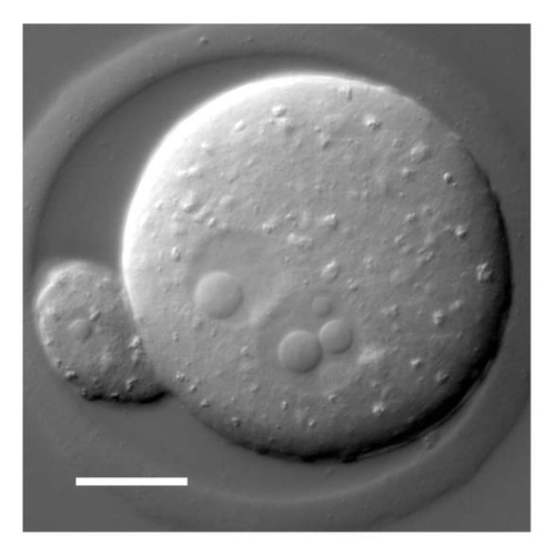 Figure 8 DIC image of a living mouse egg shortly before fusion of the two pronuclei. In this focal plane the female pronucleus displays a single large nuclear body, whereas the slightly larger male pronucleus shows one small and two large bodies. The polar body nucleus also appears to contain a small nuclear body. Note the superficial similarity to the induced nuclear bodies of Drosophila.