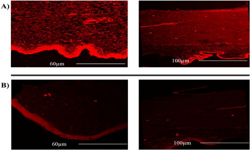 Figure 4. Confocal laser scanning micrographs of existed goat cornea at different penetration depth (60 -100 µm) following treatment with A) cubosomal disperion B) for Rhodamine B dye solution.
