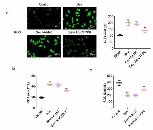 Figure 5. Overexpression of CTRP6 alleviated the sevoflurane induced oxidative stress of primary cells of central nervous tissue. (a) Probe was used for the detection of the ROS levels in these primary cells. (b, c) Commercial kits were used for the measurement of the levels of MDA and SOD in these primary cells. #p< 0.05, **p< 0.01