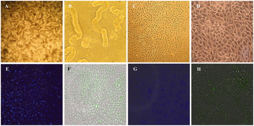 Figure 1. Light microscopy images and characterization of PTECs. Proximal tubules on the first day of seeding at 10× magnification (A) and 40× magnification (B); PTECs on the 10th day of seeding at 10× magnification (C) and 40× magnification (D). Immunocytochemical staining of PTECs with NucBlueTM Live Cell Stain (E), megalin (F), AQP-1 and AQP-2 (G), and aminopeptidase N (H).