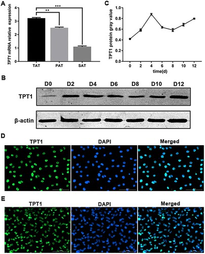 Figure 1. Expression patterns and localization of TPT1. (A) mRNA expression of TPT1 in the tail adipose tissue (TAT), perirenal adipose tissue (PAT) and subcutaneous adipose tissue (SAT). (B, C) The protein and mRNA expression profiles of TPT1 in the adipogenesis of ovine SVFs, respectively. (D) Immunofluorescence indicates the TPT1 protein is located in the nucleus of C3H10T1/2 cells. (E) Immunofluorescence indicates the TPT1 protein is located in the nucleus of ovine SVFs. *P < 0.05, **P < 0.01, ***P < 0.001.