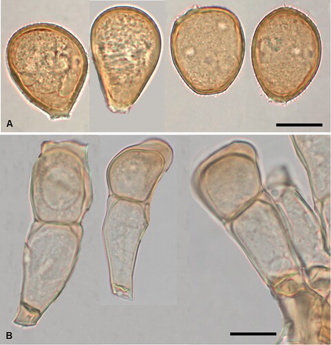 Figure 8. Puccinia cenchricola on Cenchrus caliculatus: A, Urediniospores. B, Teliospores. Scale bars = 20 μm.