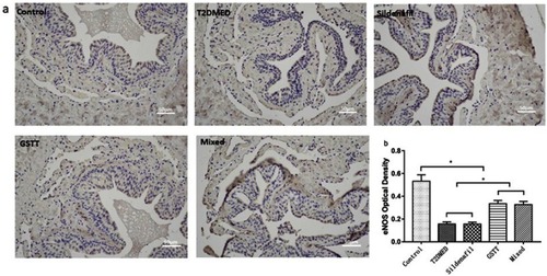 Figure 2 Shows the expression of eNOS in the corpus cavernosum of rats.