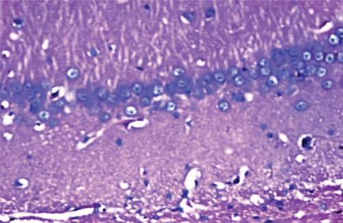 Figure 22. The shape of the hippocampus in the case exposed to Wi-Fi waves + the stereotype.