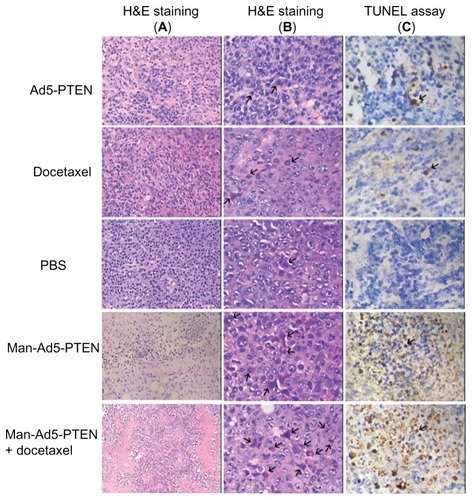 Figure 6 In vivo tumor cell death study of Man-Ad5-PTEN in combination with docetaxel. The H22 tumor-bearing mice were treated as mentioned earlier with Ad5-PTEN, docetaxel, phosphate-buffered solution, Man-Ad5-PTEN, or Man-Ad5-PTEN-docetaxel. Tumor sections were excised, fixed, dewaxed, and followed by standard H&E staining for necrosis (A, 200×) and apoptosis (B, 400×). As the arrow indicates, condensation and fragmentation of nuclei were observed, which are the hallmarks of apoptosis. Detection of apoptotic cells were also carried out by TUNEL assay (C, 400×).Abbreviations: Man, mannan; Ad5, recombinant adenovirus using the PTEN gene; PTEN, phosphatase and tensin homolog deleted on chromosome ten; TUNEL, terminal deoxynucleotidyl transferase-mediated dUTP nick end labeling.