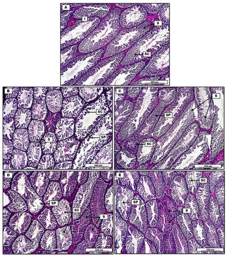 Figure 8 Photomicrograph of testis from groups; (A) control group, display consistent numbers of seminiferous tubules (S), separated by interstitial connective tissue (I) lined by uniformly arranged spermatogenic cells (SC). (B) Doxorubicin group show a significant reduction in spermatogenesis (SC), decrease in seminiferous tubules spermatogenic cells (S), together with severe degenerative changes in germinative sperm cell layers (SP). (C) Doxorubicin, quercetin and sitagliptin group reveal significant germinal regeneration in the spermatogenic cells (SC). Repopulation in the germinative cells of spermatogenesis (SP). Some tubules show degenerative changes in lining germinal epithelium (S). (D) Doxorubicin and sitagliptin group show regenerative changes in some seminiferous tubules (S), spermatogenic cells (SC) show typical degenerative-atrophy changes, and germinative spermatogenesis epithelium debris within the testicular tubules (SP). (E) Doxorubicin and quercetin group display significant regeneration in seminiferous tubular germinal epithelium (S), marked cellular debris within the tubular lumen (SP), and degenerative changes in spermatogenic cells (SC). H&E. Scale bars: 500 µm.