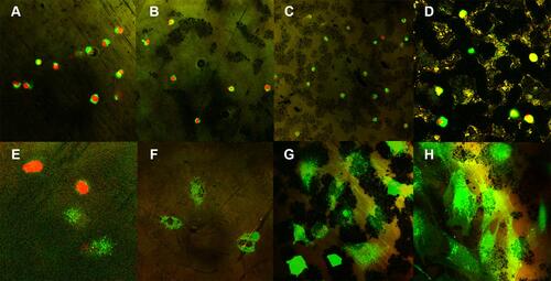Figure 8 Fluorescent staining images of cells cultured for either 24 h (64× confocal laser scanning microscope mode). (A) the control group; (B) Group N; (C) Group NA; and (D) Group NAG. Fluorescent staining images of cells cultured for either 5 days (128× confocal laser scanning microscope mode). (E) the control group; (F) Group N; (G) Group NA; and (H) Group NAG. Green fluorescence indicates viable cells and red fluorescence indicates dead cells.