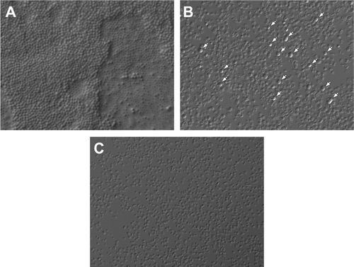 Figure 5 Staphylococcus aureus biofilm microscopic visualization (Nomarski optics ×1000).